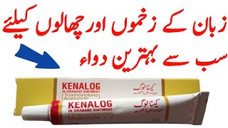 Kenalog in orabase ointment review  mouth infection Soultion [upl. by Egiaf]