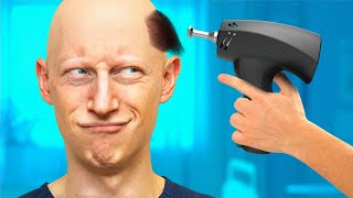 Top 5 NEW Hair Restoration Treatments YOU Need To Know About [upl. by Llenrad296]