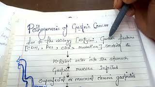 pathogenesis of gastric cancer NGMedicals [upl. by Ander]