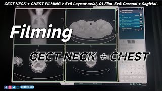 CECT Neck  Chest Filming  By Anis Qureshi [upl. by Aggie]