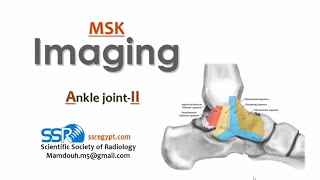 13 Ankle joint imaging II TEC Prof Mamdouh Mahfouz [upl. by Genovera249]