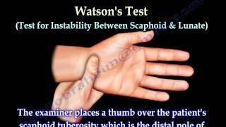 Examination Of The Hand Tests  Everything You Need To Know  Dr Nabil Ebraheim [upl. by Ecarg]