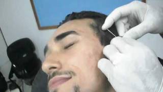 Aplicação de Piercing Transversal  Diogo [upl. by Odlaw]