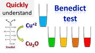 Benedicts test [upl. by Ezmeralda]