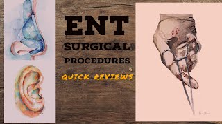 ENT SURGICAL PROCEDURES lecture 4 CORTICAL MASTOIDECTOMY with important points [upl. by Alidus]