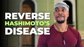 How To Reverse Hashimotos Disease amp Hypothyroidism  High Raw Vegan Nutritionist [upl. by Tally282]