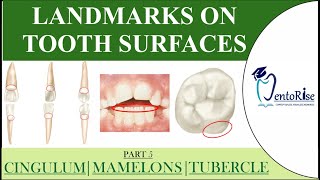 Landmarks on tooth surfaces Part5 CINGULUM  TUBERCLE  MAMELONS  Tooth landmarks Dental Anatomy [upl. by Aivlys]