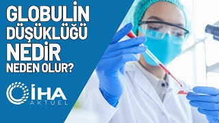 Globulin Düşüklüğü Nedir Neden Olur [upl. by Asertal]