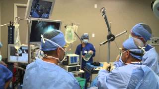 Shoulder Surgery Arthroscopy OR Setup and Patient Positioning [upl. by Tisha]