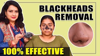 Blackheadsக்கு நிரந்தர தீர்வு  Natural Home Remedies  Vasundhara Skin Care Tips [upl. by Boardman]