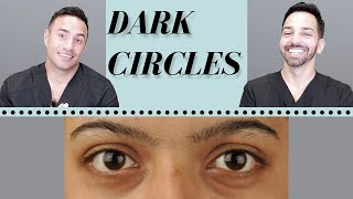 Dark Circles Causes amp Treatments  Dermatologist Perspective [upl. by Sage]