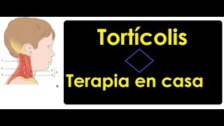 Tortícolis congénita tensión en cuello  Terapia en casa [upl. by Notterb]