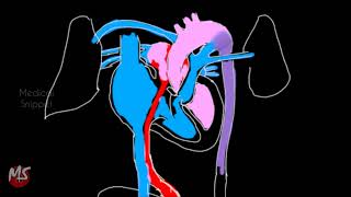 Fetal Circulation  Anatomy  Made easy  3 minutes [upl. by Ahsenod]