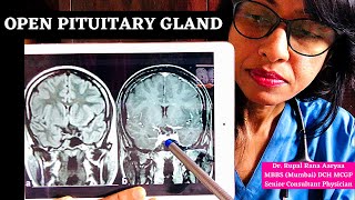 👉 HEIGHT GROWTH HOW TO OPEN PITUITARY GLAND NATURALLY Increase HGH Release Dr Rupal [upl. by Htinnek496]