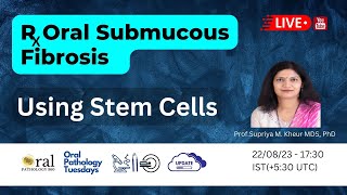 Harnessing the potential of mesenchymal stem cells in the treatment of Oral Submucous Fibrosis [upl. by Ecilef766]