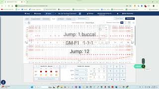 Voice Enabled Perio Charting amp PHI Reporting for Dentrix Ascend with Denti AI Voice [upl. by Baskett]