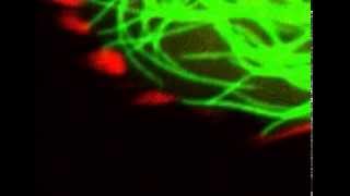 Microtubules poking focal adhesions [upl. by Lady]