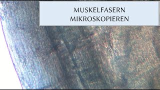 MUSKELZELLEN MIKROSKOPIEREN [upl. by Northey392]