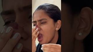 Accha nahi kiye allo ne 😧  mrshanua  shortsvideo explorepage couplegoals funny viralreels [upl. by Kcerb]