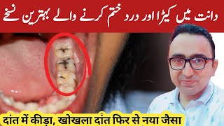 Top 4 Home Remedies For Tooth Cavity  Dental Carries  Dr Javaid [upl. by Rind789]