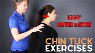 Chin Tuck Exercise  Before and After text neck [upl. by Janey]