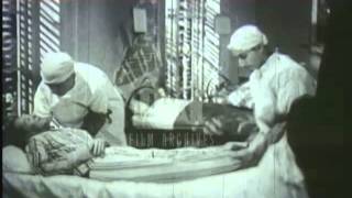 Naples Typhus outbreak 1944 Archive film 92122 [upl. by Cimah767]