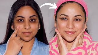 How I got rid of HYPERPIGMENTATION with this simple change to my routine [upl. by Meesaw]