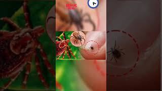 scrub typhus currentaffairsopsc news shorts viralvideo scrub typhus [upl. by Billy]