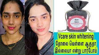 I tried vcare skin whitening soap for 15 days✌🏻✨unsponsored review💯 [upl. by Eudoca]