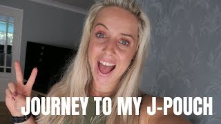 Why Ive decided to have JPouch surgery [upl. by Enived]