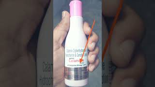 calamine lotion uses  complete allergy treatment [upl. by Yrolam]