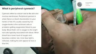 Peripheral Cyanosis  Practical viva  Clinical [upl. by Llenyt]