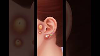 ASMR Ear Cleaning ✨✨ asmr gaming asmrcleaning [upl. by Auhs]