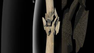 Common Types Of Bone Fracture Explained  3D animation [upl. by Steffy]