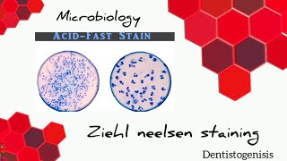 Ziehl Neelsen staining  Acid Fast staining microbiology 2ndyear BDS [upl. by Eaneg232]