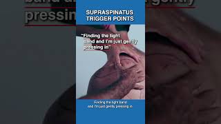 How to Release Supraspinatus Trigger Points [upl. by Kassandra817]