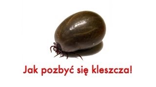 Kleszcz Poradnik jak usunąć kleszcza Wyjmowanie kleszcza [upl. by Nessej]