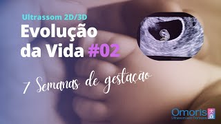 Gravidez semana a semana AO VIVO  Ultrassom 7 semanas  Evolução da Vida 02 [upl. by Millman82]