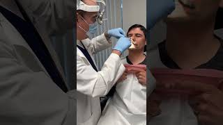 Nasal splint removal 7 days after a septoplastyno discomfort [upl. by Yesac696]