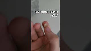 My tooth came out [upl. by Westney]