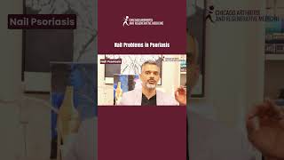 Nail Problems in Psoriasis ChicagoArthritis RheumatoidArthritis ArthritisTreatment RAawareness [upl. by Prospero]