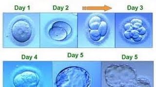 IVFTTC Journey 56 Embryo update [upl. by Kaliope]