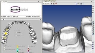 CAD CAM Dental Scanner Streifenlichtscanner Teeth cnc 4  5 axis Achsen Zirkon machining bridge [upl. by Rehpotsrik]