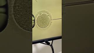 Intracytoplasmic Sperm Injection ICSI [upl. by Faline386]