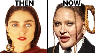 Madonna Plastic Surgeries  Surgeon Reacts [upl. by Grondin]