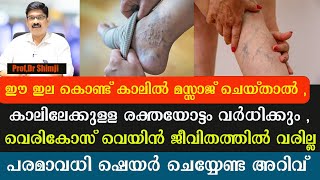 വെരികോസ് വെയിൻ പൂർണ്ണമായും മാറാനും ജീവിതത്തിൽ വരാതിരിക്കാനും Varicose Vein  Dr Shimji [upl. by Leodora282]