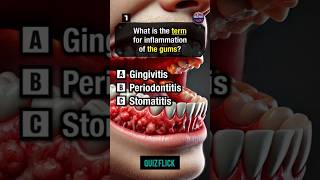 Medical knowledge Quiz part 34shorts [upl. by Suirtemid330]