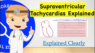 Supraventricular Tachycardia  Pathophysiology Diagnosis Subtypes 12 Lead ECG and Management [upl. by Ivah928]