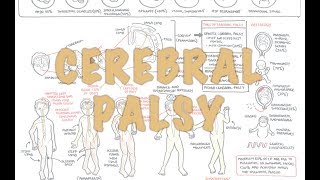 Cerebral Palsy  DETAILED Overview [upl. by Teodor]