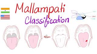 Mallampati Score Classification for Airway Management [upl. by Ellerrehc]